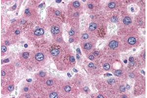 Human Liver (formalin-fixed, paraffin-embedded) stained with APOC1 antibody ABIN351488 at 3. (APOC1 anticorps  (AA 70-83))