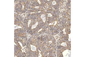 IHC analysis of TST using anti-TST antibody (ABIN7599105). (TST anticorps  (AA 1-220))