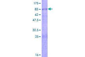 Image no. 1 for F-Box Protein 38 (FBXO38) (AA 1-426) protein (GST tag) (ABIN1353819)