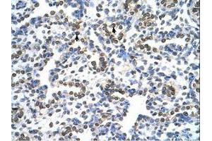 Image no. 1 for anti-Mitochondrial Ribosomal Protein S15 (MRPS15) (AA 51-100) antibody (ABIN6737717)