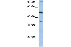 PLXDC1 antibody used at 1 ug/ml to detect target protein. (PLXDC1 anticorps  (N-Term))