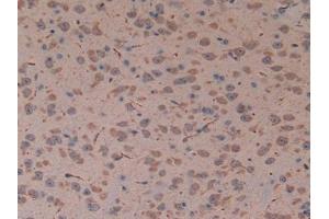 Detection of P53 in Mouse Brain Tissue using Polyclonal Antibody to Tumor Protein p53 (P53)