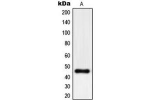 Western blot analysis of PHKG1 expression in A375 (A) whole cell lysates. (PHKG1 anticorps  (Center))