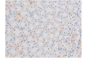 ABIN6256390 and ABIN6267486 at 1/200 staining Rat kidney tissue sections by IHC-P. (IRS1 anticorps  (pSer639))