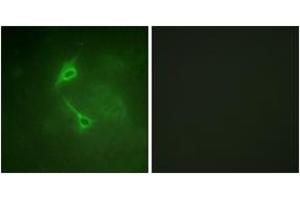 Immunofluorescence analysis of NIH-3T3 cells, using PKC zeta (Ab-560) Antibody.