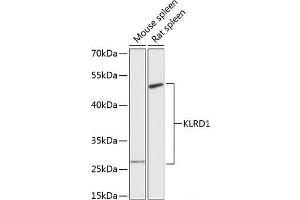 Western blot analysis of extracts of various cell lines using KLRD1 Polyclonal Antibody at dilution of 1:3000. (CD94 anticorps)