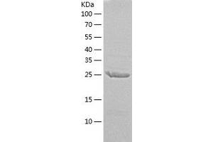 Western Blotting (WB) image for Exosome Component 7 (EXOSC7) (AA 1-291) protein (His-IF2DI Tag) (ABIN7122864)