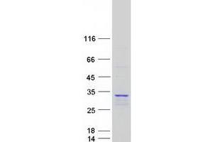 Validation with Western Blot
