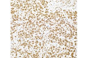 anti-RNA-binding protein Raly (RALY) (AA 256-306) antibody
