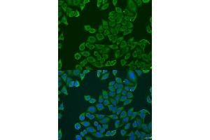 Immunofluorescence analysis of U2OS cells using RPL36 antibody.