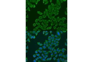 Immunofluorescence analysis of U2OS cells using RPL36 antibody. (RPL36 anticorps  (AA 1-105))