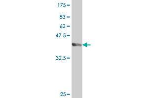 Western Blot detection against Immunogen (37.