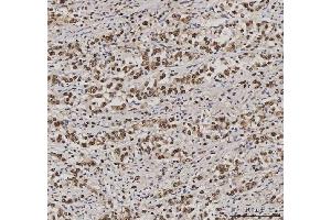 IHC analysis of PC4/SUB1 using anti-PC4/SUB1 antibody (ABIN7602185). (SUB1 anticorps  (AA 62-127))