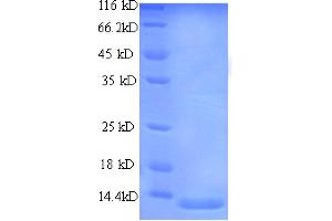 SDS-PAGE (SDS) image for Chemokine (C-X-C Motif) Ligand 13 (CXCL13) (AA 23-95), (partial) protein (His tag) (ABIN5712455)