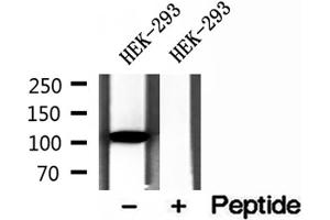 Western blot analysis of extracts of HEK-293 cells, using DIAPH3 antibody. (DIAPH3 anticorps  (Internal Region))