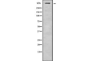 Western blot analysis of ASPM using HeLa whole cell lysates