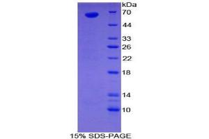 SDS-PAGE analysis of Human Sulfatase 1 Protein. (SULF1 Protéine)