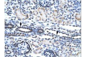 Image no. 2 for anti-V-Ets erythroblastosis Virus E26 Oncogene Homolog 1 (Avian) (ETS1) (AA 52-101) antibody (ABIN202532)