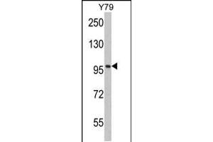 Western blot analysis of KPNB1 Antibody in Y79 cell line lysates (35ug/lane) (KPNB1 anticorps  (N-Term))