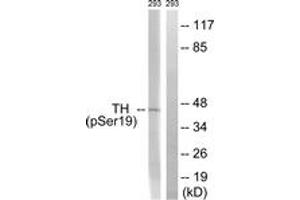Western blot analysis of extracts from 293 cells treated with Insulin 0. (Tyrosine Hydroxylase anticorps  (pSer18))