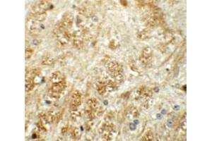 Immunohistochemical staining of mouse brain cells with ATP2C1 polyclonal antibody  at 5 ug/mL. (ATP2C1 anticorps  (C-Term))