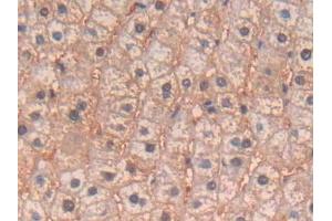 IHC-P analysis of Human Liver Tissue, with DAB staining. (IL-4 anticorps  (AA 25-153))