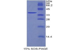 SDS-PAGE analysis of Mouse DKK4 Protein. (DKK4 Protéine)