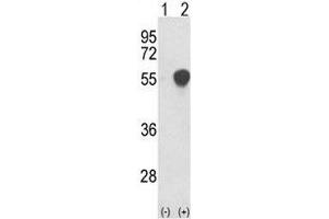 Western blot analysis of PHGDH antibody and 293 cell lysate either nontransfected (Lane 1) or transiently transfected with the PHGDH gene (2). (PHGDH anticorps  (AA 140-168))