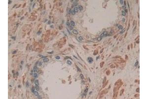 Detection of SDF2 in Human Prostate Tissue using Polyclonal Antibody to Stromal Cell Derived Factor 2 (SDF2)