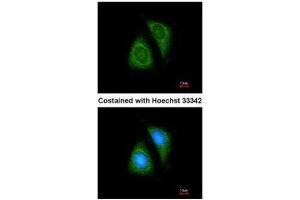 ICC/IF Image Immunofluorescence analysis of methanol-fixed HeLa, using SHP1, antibody at 1:200 dilution. (SHP1 anticorps  (Center))
