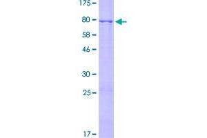 Image no. 1 for Zinc Finger Protein 596 (ZNF596) (AA 1-498) protein (GST tag) (ABIN1326320)