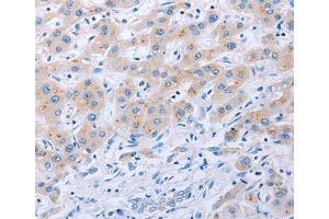Immunohistochemistry (IHC) image for anti-Fibroblast Growth Factor 4 (FGF4) antibody (ABIN2425618) (FGF4 anticorps)