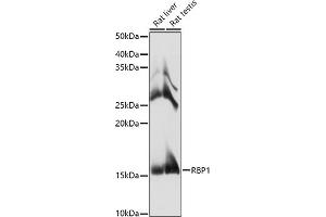 RBP1 Antikörper  (AA 63-197)