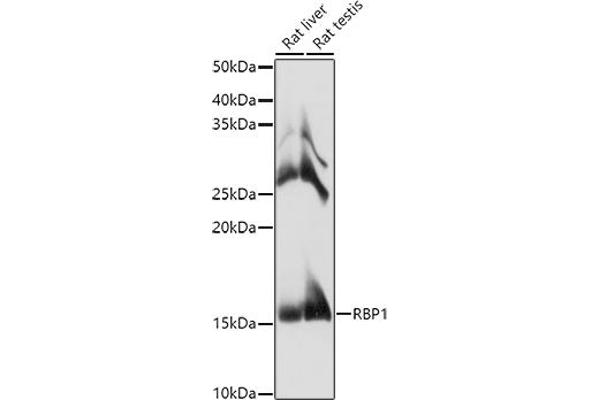 RBP1 抗体  (AA 63-197)