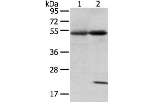 Gel: 8 % SDS-PAGE, Lysate: 80 μg, Lane 1-2: Human lung cancer and placenta tissue, Primary antibody: ABIN7192580(SNTA1 Antibody) at dilution 1/200 dilution, Secondary antibody: Goat anti rabbit IgG at 1/8000 dilution, Exposure time: 1 minute (SNTA1 anticorps)