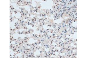 Immunohistochemistry of paraffin-embedded Mouse lung using ZNF433 Polyclonal Antibody at dilution of 1:100 (40x lens). (ZNF433 anticorps)