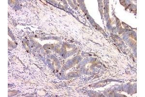 IHC analysis of Cystatin C/CST3 using anti-Cystatin C/CST3 antibody (ABIN6719299). (CST3 anticorps  (AA 31-146))