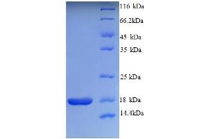 SDS-PAGE (SDS) image for Neurotrophin 4 (NTF4) (AA 82-210) protein (His tag) (ABIN5712712) (Neurotrophin 4 Protein (NTF4) (AA 82-210) (His tag))