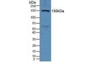 Detection of VEGFR2 in Rat Serum using Polyclonal Antibody to Vascular Endothelial Growth Factor Receptor 2 (VEGFR2) (VEGFR2/CD309 anticorps  (AA 46-320))