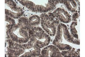 Image no. 8 for anti-OTU Domain, Ubiquitin Aldehyde Binding 1 (OTUB1) antibody (ABIN1499932)