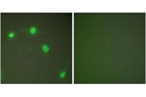 Immunofluorescence analysis of COS7 cells, using Ku70 Antibody.
