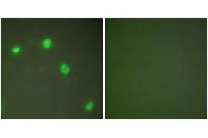 Immunofluorescence analysis of COS7 cells, using Ku70 Antibody. (XRCC6 anticorps  (AA 560-609))
