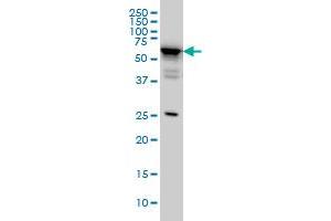 DDX56 monoclonal antibody (M05), clone 4C5 Western Blot analysis of DDX56 expression in HeLa .