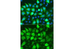 Immunofluorescence analysis of A549 cells using RRM2 antibody. (RRM2 anticorps  (AA 1-389))