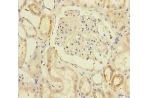 Immunohistochemistry of paraffin-embedded human kidney tissue using ABIN7171203 at dilution of 1:100 (RIC8A anticorps  (AA 362-531))