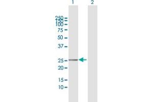 Western Blot analysis of TMEM177 expression in transfected 293T cell line by TMEM177 MaxPab polyclonal antibody. (TMEM177 anticorps  (AA 31-311))