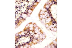 (ABIN655484 and ABIN2845005) staining RSBN1 in human colon tissue sections by Immunohistochemistry (IHC-P - paraformaldehyde-fixed, paraffin-embedded sections). (RSBN1 anticorps  (N-Term))