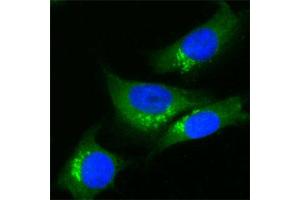 Human Melanoma cell line C 32 was cultured overnight on round cover slides placed in a 24 well tissue culture plate.