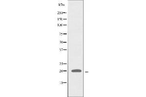 Western blot analysis of extracts from A549 cells, using ATP5L2 antibody. (ATP5L2 anticorps  (C-Term))
