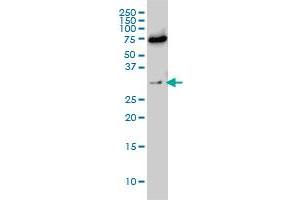 EXOSC8 monoclonal antibody (M01), clone 1G5 Western Blot analysis of EXOSC8 expression in Hela S3 NE . (EXOSC8 anticorps  (AA 1-276))